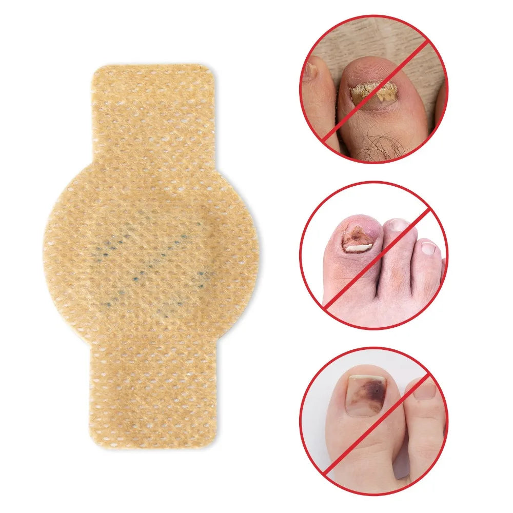 NailCure - Elimina los hongos en las uñas en 7 días